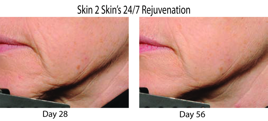Rethinking Skin Aging with The Powerful Peptide Progeline!