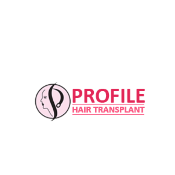 Profile Forte Offering Hair Loss Patients With Modern Hair Transplant Methods