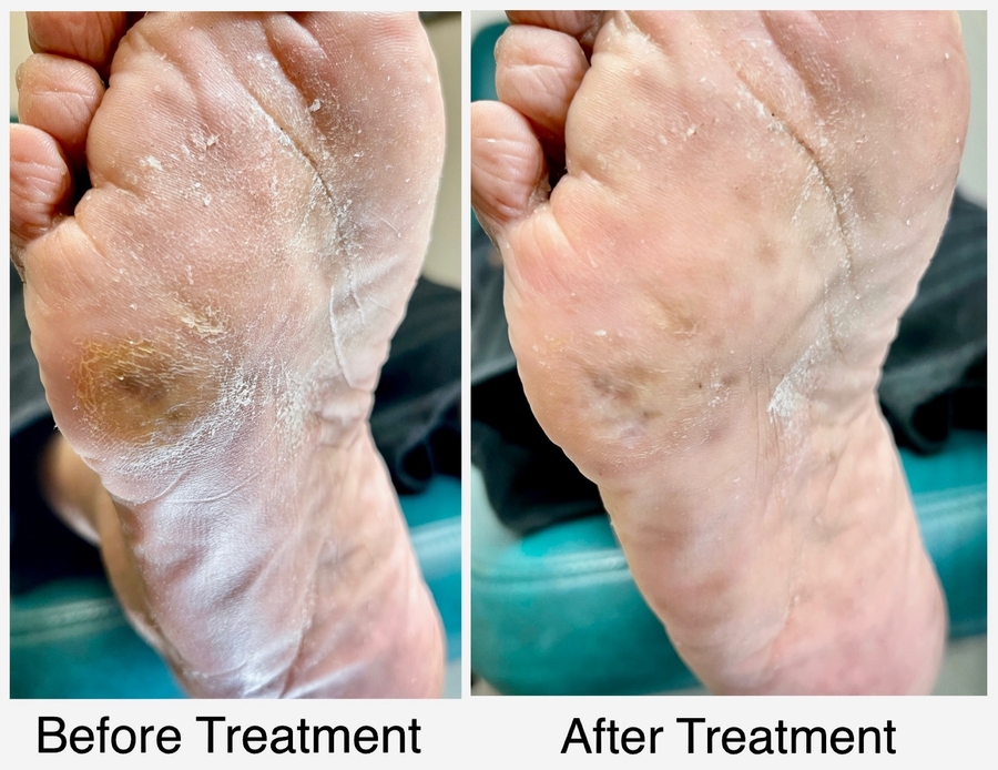 Aesthetic Podiatry: Can Your Feet Look and Feel Younger?
