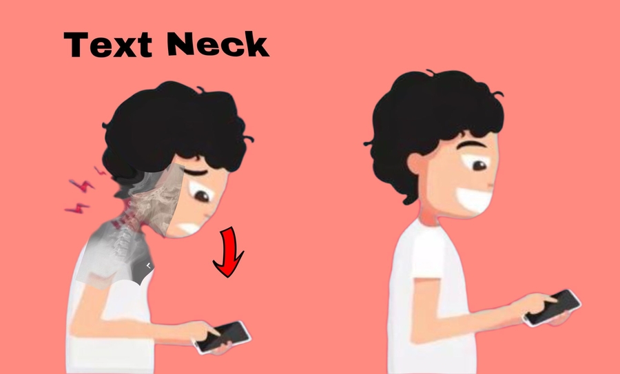 Fix Text Neck with Chiropractic, Study Suggests Chiropractor-Approved Maintenance Care