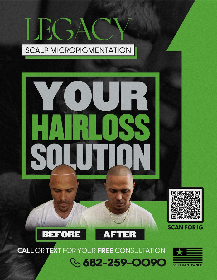 Legacy SMP – Bringing You a Non-Invasive Hair Loss Solution