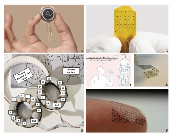 Beyond the brain: how BCIs are rewiring medicine and redefining humanity