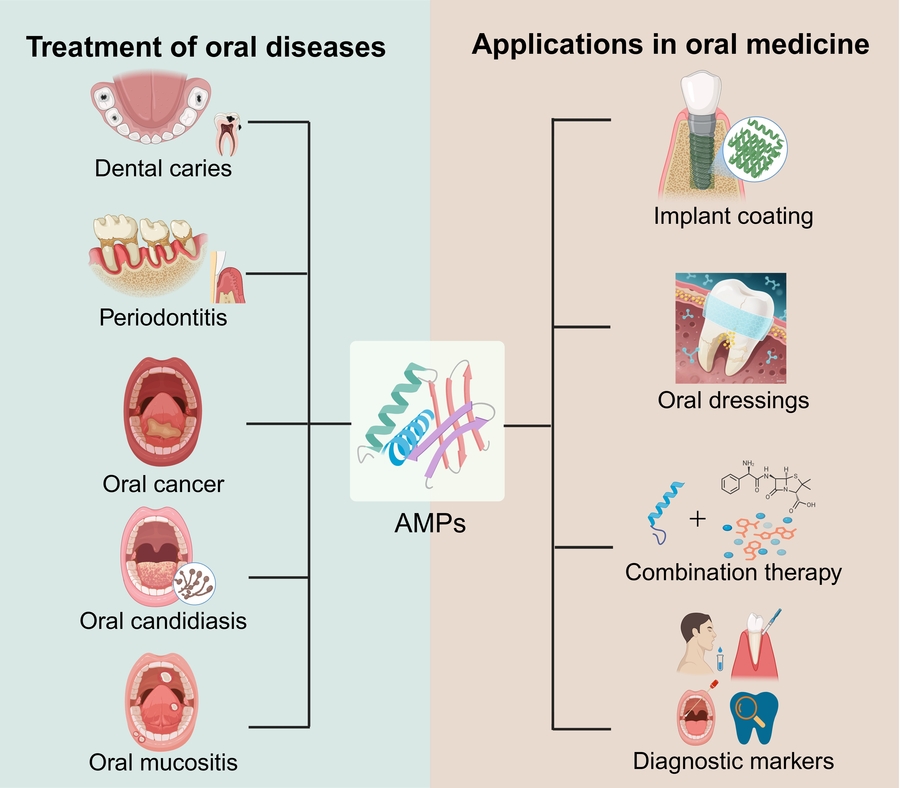 Antimicrobial peptides in oral medicine: From mechanisms to clinical translation