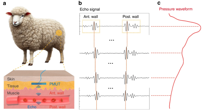 Sheep study shows tiny ultrasound array can track blood pressure under the skin