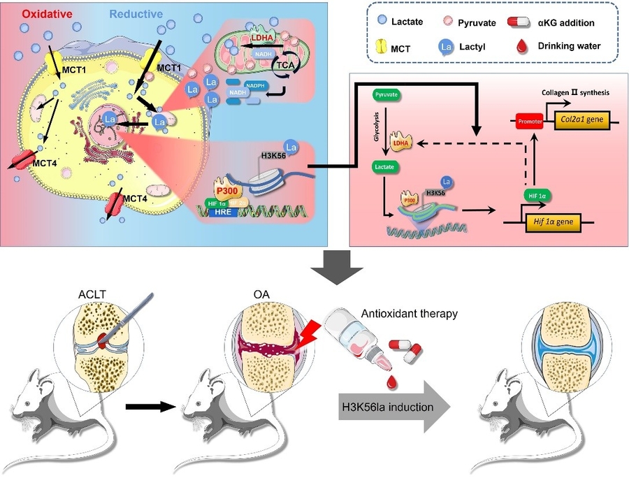 How lactate rewrites cartilage genes to attenuate post-traumatic osteoarthritis