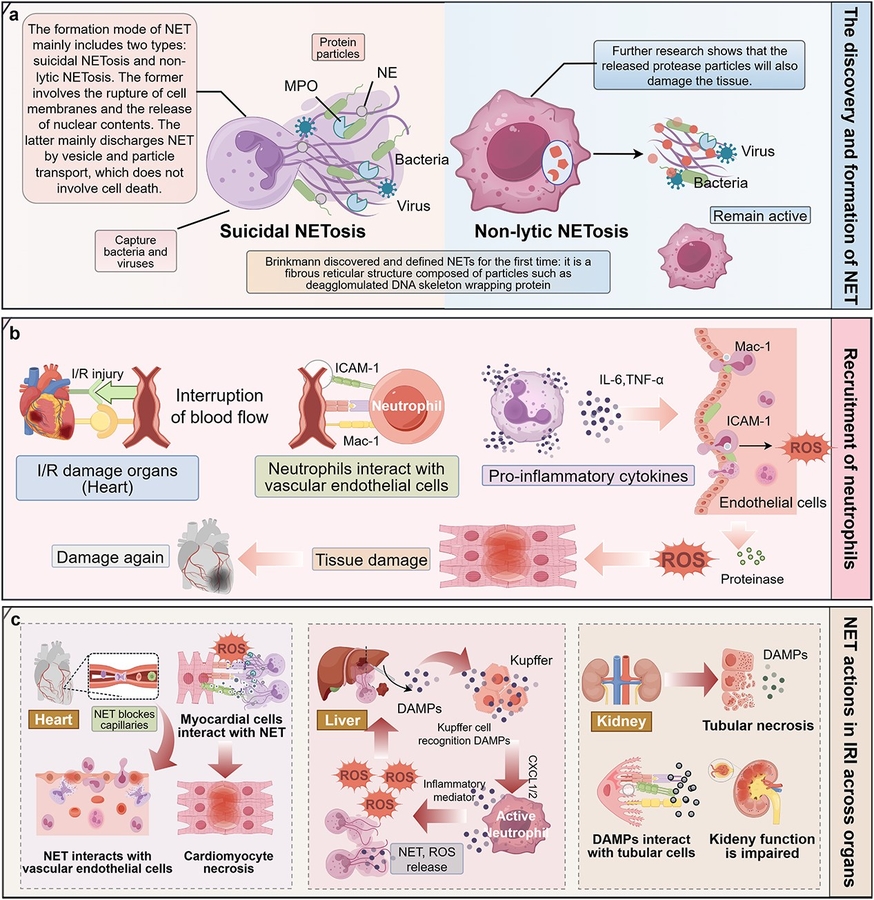 Immune webs shape reperfusion injury