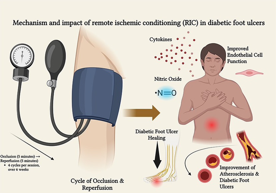 Remote signals may help preserve diabetic limbs