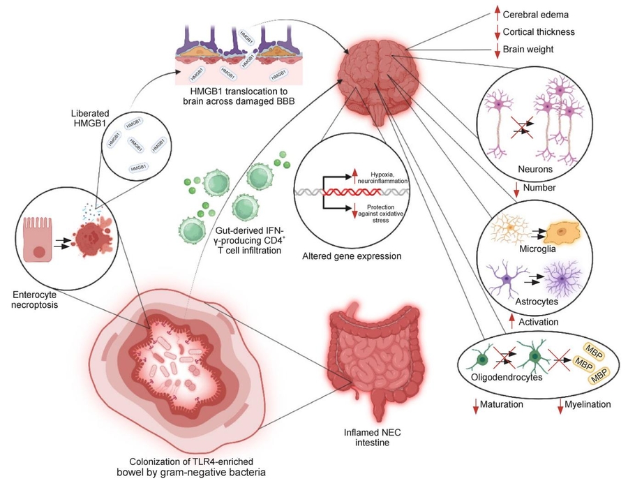 Beyond the Gut: Necrotizing Enterocolitis Drives Neurodevelopmental Impairment Through Gut-Derived Inflammation